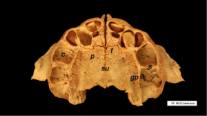 Occlusal view of the articulated maxillae in a later-stage fetus with teeth beginning to form in the dental crypts.