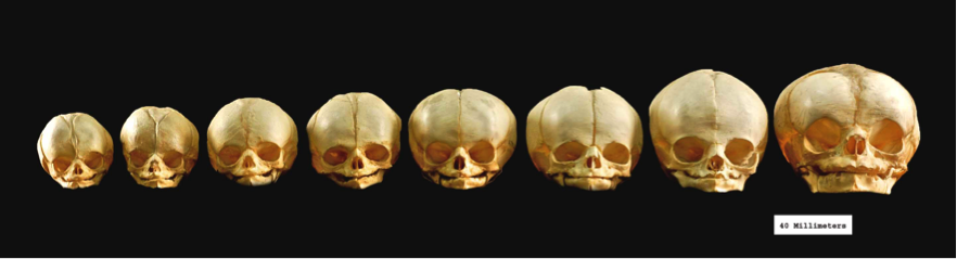 Fetal skulls